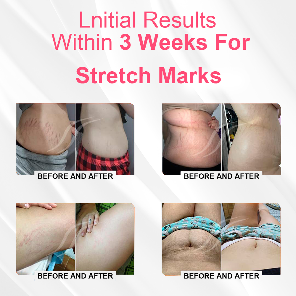 🔥Yagoo™ Modulateur Magnétique Nano Ionique Brûle-Graisse