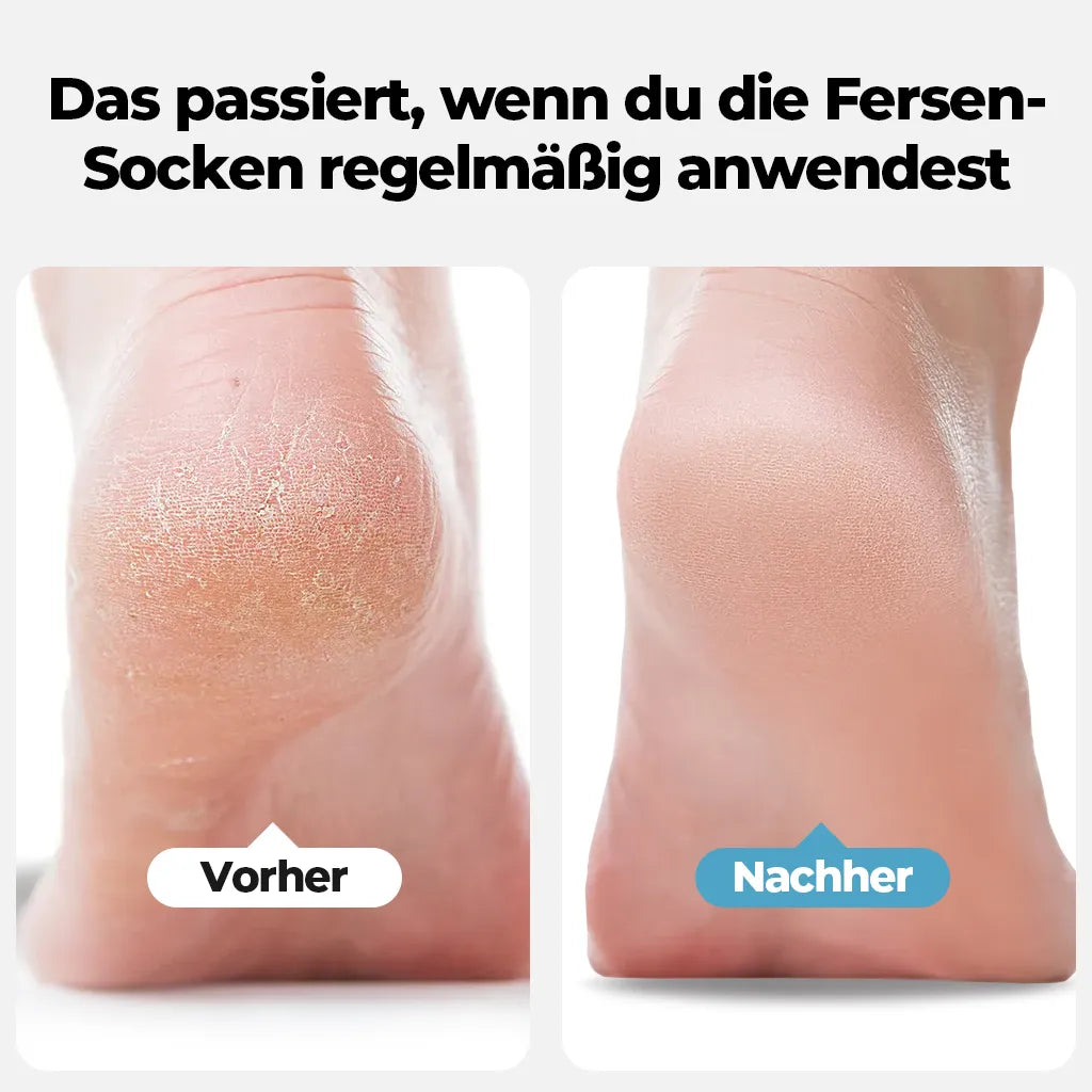SleepNap|Chaussettes de Talon